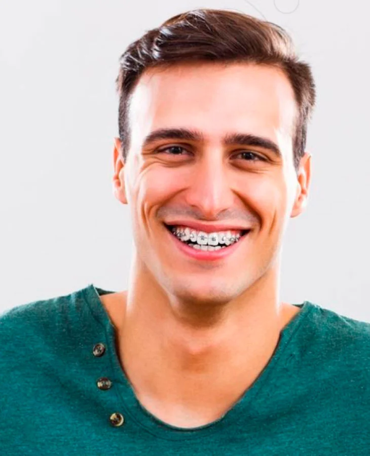 KS-Fogszabalyozo-studio-lathatalan-fogszabalyozas