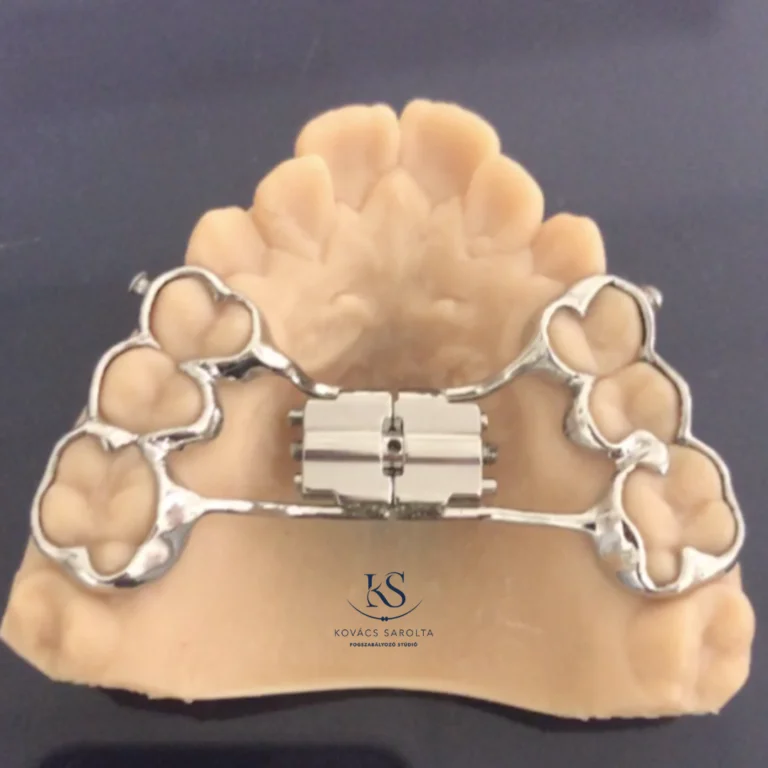KS-Fogszabalyozo-studio-lathatalan-fogszabalyozas